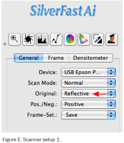 Figure E, Scanner Setup #1